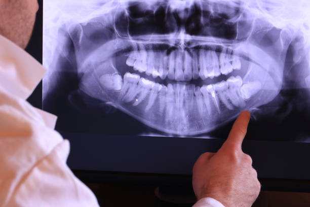 Best Emergency Dentist for Special Needs Patients in Danvle, IL