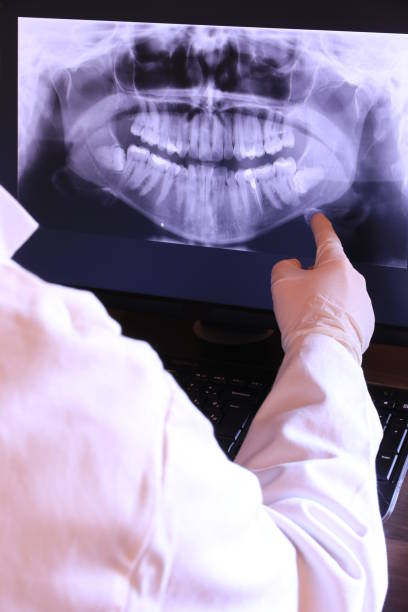 Best Emergency Dentist for Lost Fillings or Crowns in Danvle, IL