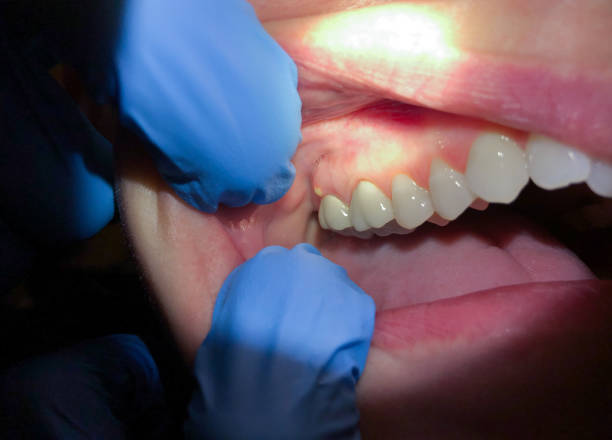 Best Urgent Dental Care for Toothache in Danvle, IL