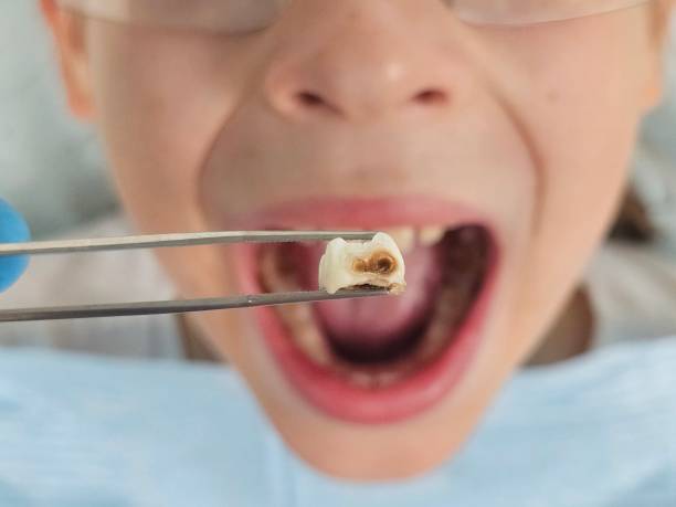 Best 24-Hour Emergency Dentist in Danvle, IL
